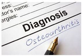 osteoarthritis and diagnosis